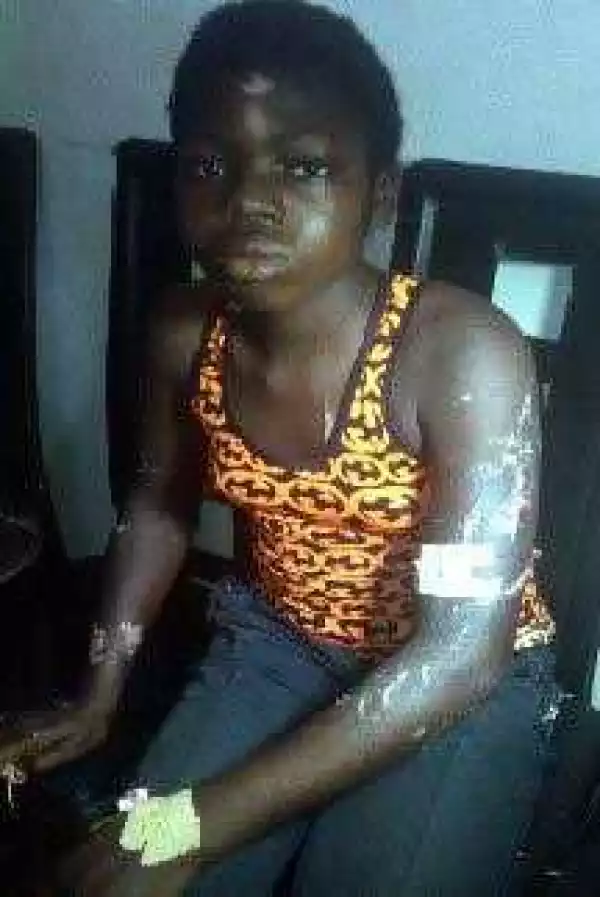 My employer ordered relative to disfigure me with pressing iron – Housemaid cries out